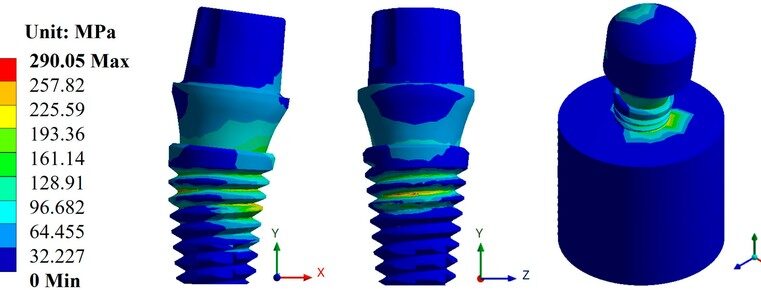 Fatigue Testing for Biomedical Implants: Advances and Challenges