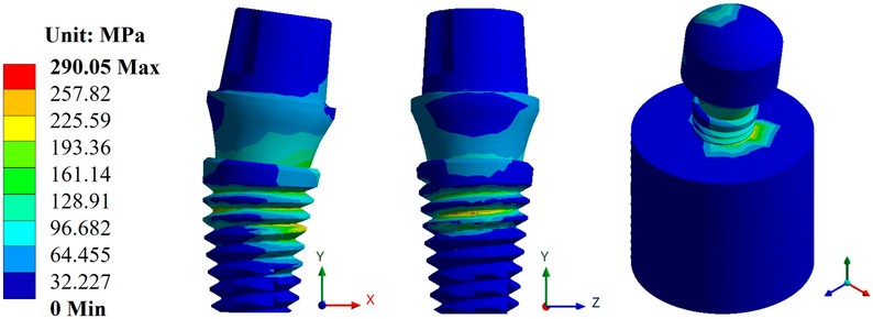 Fatigue Testing for Biomedical Implants: Advances and Challenges